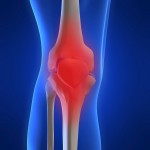 Solutions That Are Resolving Knee Pain